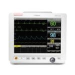 monitor-de-paciente-adulto-pediatrico-neonatal-o-unidad-principal-monitor-121-tft-lcd-color-o-almacenamiento-y-revision-de-datos