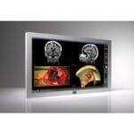 monitor-quirurgico-led-full-hd-de-42-2mp-el-mdsc-2242-de-barco-es-un-monitor-para-cirugia-con-pantalla-grande-de-42-pulgadas-luz