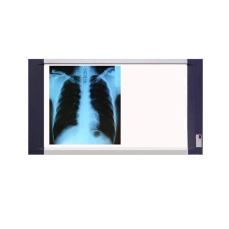 NEGATOSCOPIO TIPO LED XR DOBLE 6500 LUX