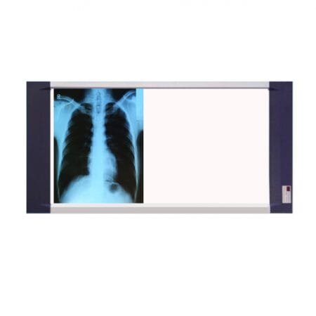 NEGATOSCOPIO TIPO LED XR TRIPLE 6500 LUX