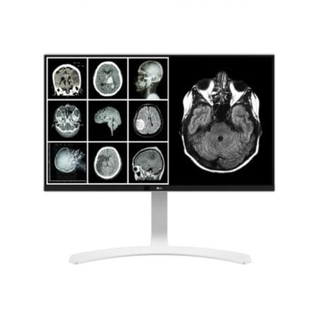 PANTALLA LG 27 PULGADAS 8 MP USO CLÍNICO/RADIOLOGÍA