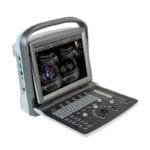 ultrasonido-doppler-co-chison-eco-6-ha-considerado-la-solicitud-mas-frecuente-del-usuario-la-adicion-de-caracteristicas-y-capaci