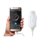 ultrasonido-ultraportatil-philips-lumify-ofrece-imagenes-de-ecografia-de-alta-calidad-a-traves-de-dispositivos-moviles-y-una-app